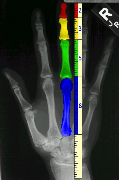 Sucesión de Fibonacci
